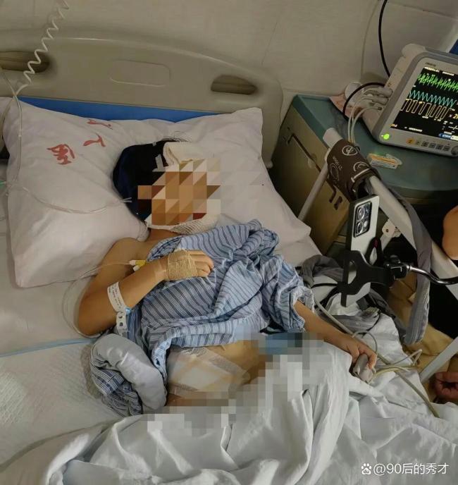 媒体评烈性犬牛头梗失控咬伤四五人 禁养犬盲区引发反思