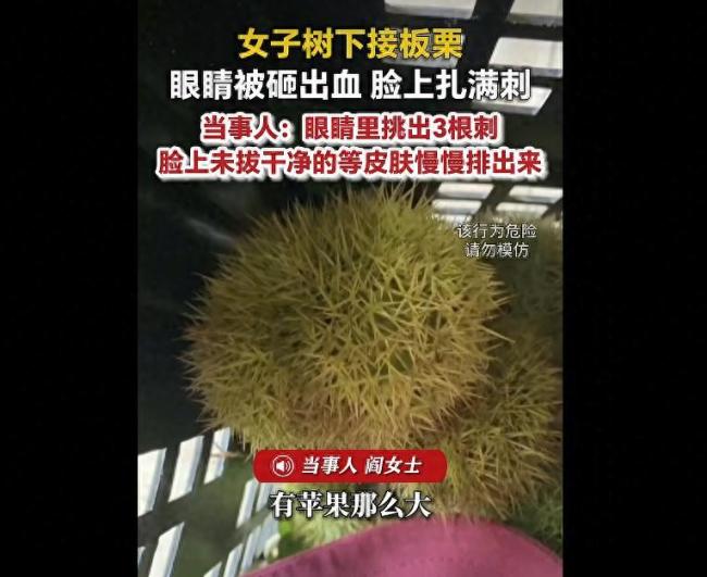 女子被板栗砸伤眼睛里挑出刺