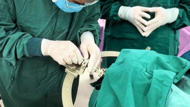 男子颅内3毫米病灶取出伸展为10厘米活虫 罕见裂头蚴病例揭秘