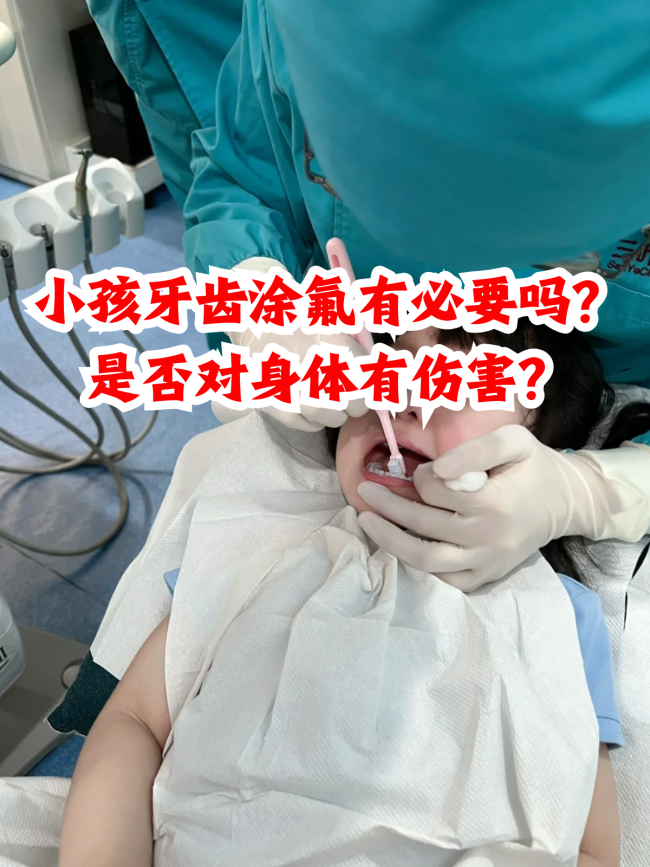 小孩牙齿涂氟好还是做窝沟封闭好?