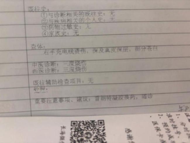 睡觉时充电线贴皮肤醒来三度烧伤 低压不等于绝对安全