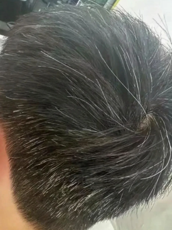 用脑过度容易长白头发?长白发是身体给的慢性压力警告