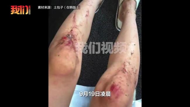遭男子闯入女子称在灌木丛躲了一夜 游客遭遇惊魂夜