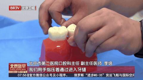 刷牙方式调整一下 别再“无效刷牙” 正确方法保护牙齿