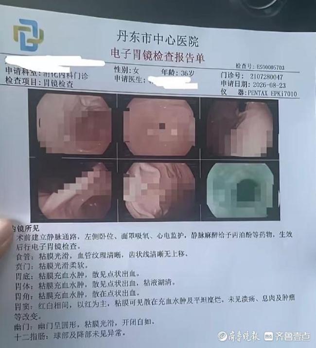 市民在医院体检遭遇蹊跷事 私立医院查出息肉三甲医院却无发现