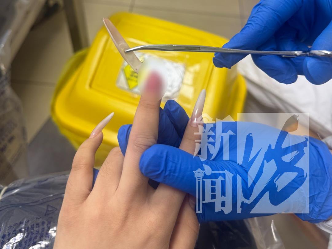 女子做超长美甲睡觉翻身连根折断 欧气爆棚传说奖