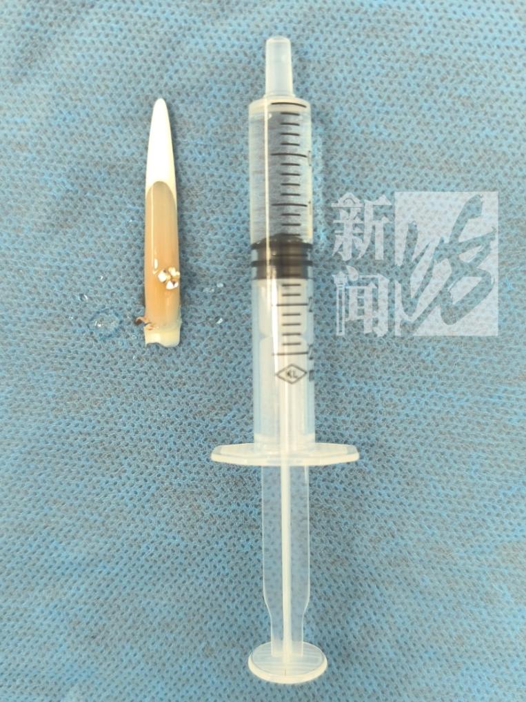 女子做超长美甲睡觉翻身连根折断 欧气爆棚传说奖