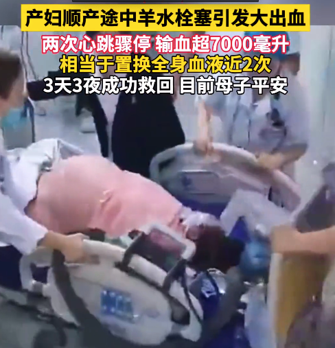 产妇突发羊水栓塞引发顽固性大出血 全身换血超7000毫升