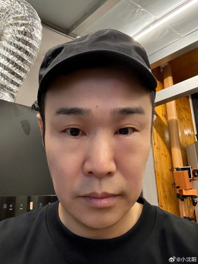 小沈阳一觉睡醒眼睛肿成蜜蜂小狗