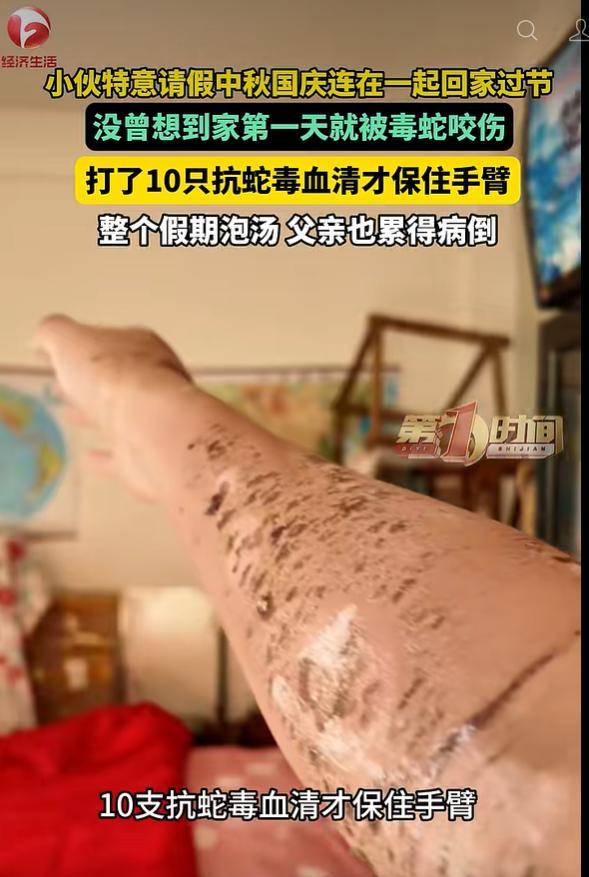 小伙下地割草遭毒蛇咬伤手臂 假期变医院之旅