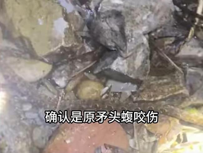 小伙下地割草遭毒蛇咬伤手臂 假期变医院之旅