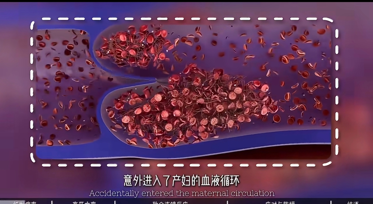 别被幸存者偏差误导,现代医学下,女性生孩子一直存在生命危险!