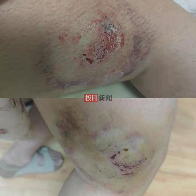 女子骑马被咬伤商家要求删差评才赔钱