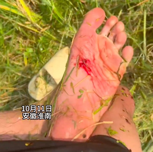 小伙脚踩收割机旋刃冒险救出机手：虽然疼，但是救人重要
