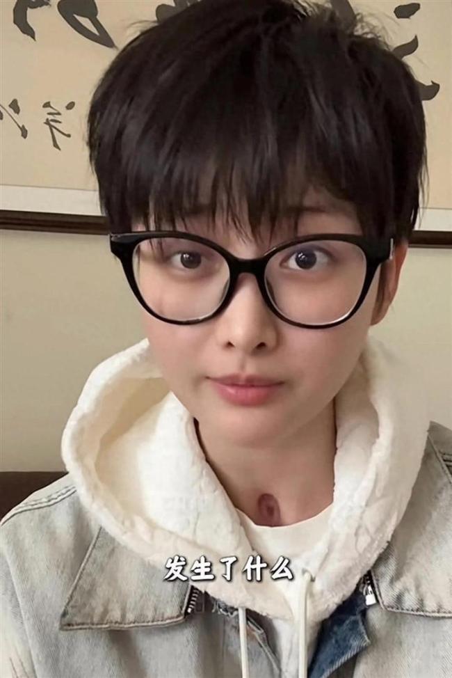 网红晚安安35楼坠落截肢后重生 奇迹康复之路