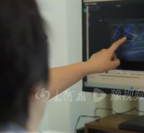女子6毫米结节确诊乳腺癌,医生提醒:乳腺微小结节隐蔽性强,很容易被忽略