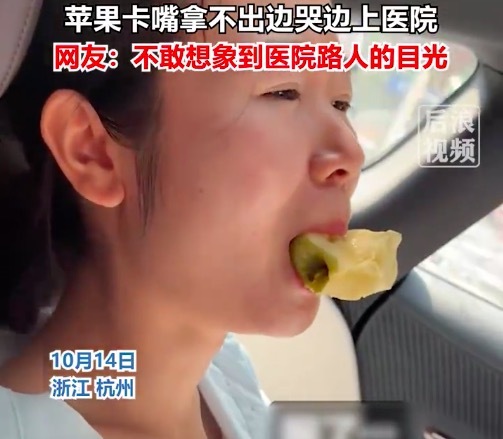 第一次见啃苹果卡嘴要到医院取出 女子吃苹果一口下去下巴脱臼
