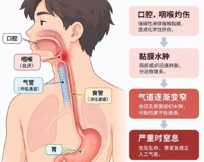 以为是饮料尝了一口是洁厕剂 清洁剂包装“仿饮料”暗藏风险