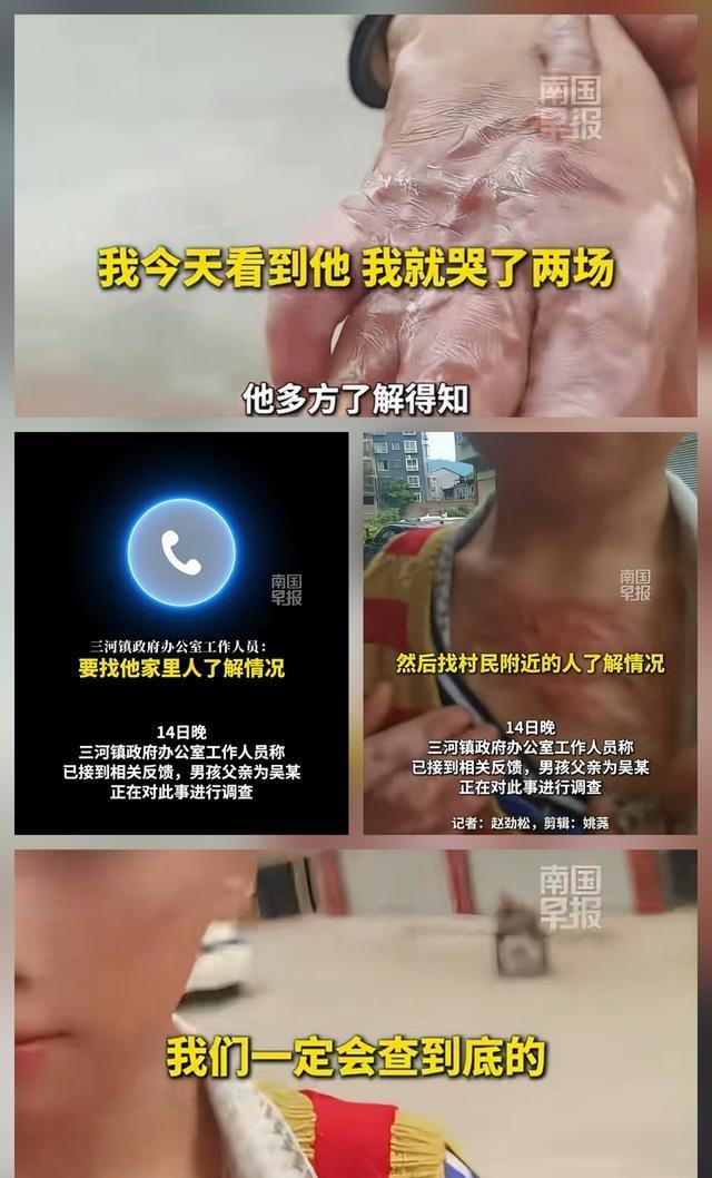 多部门介入9岁男孩全身多处烫伤疤 揭开伤痕背后的真相