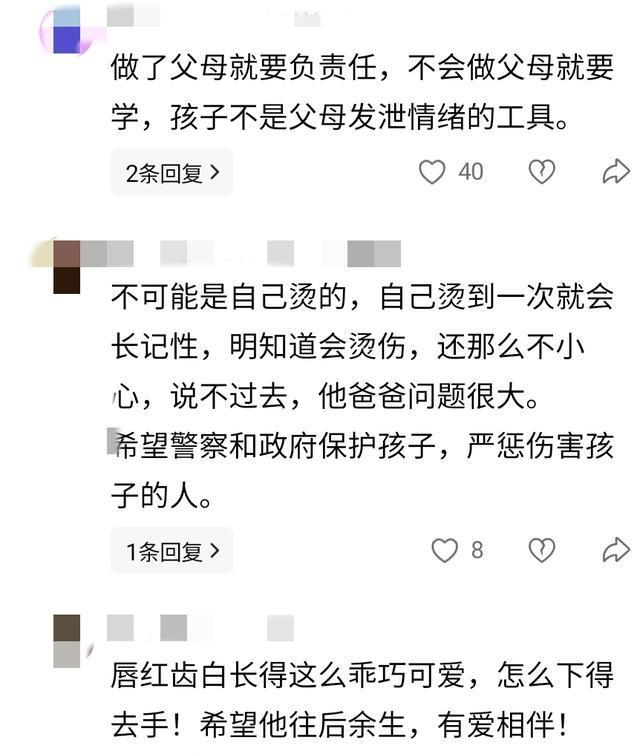 多部门介入9岁男孩全身多处烫伤疤 揭开伤痕背后的真相